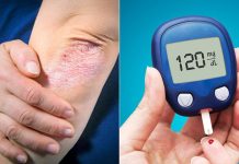 Si ndryshojnë simptomat e diabetit tek gratë dhe burrat?